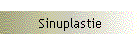 Sinuplastie